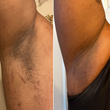 Charger l'image dans la galerie, Bushbalm - Gommage exfoliant pour taches brunes - Bermudes